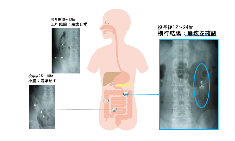 フロイント産業の大腸送達技術 次世代型サプリメントへの応用 機能性食品原料 Freund Knowledge Ocean